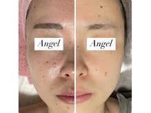 アンヘル(Angel)/６ヶ月でこんなに変化！