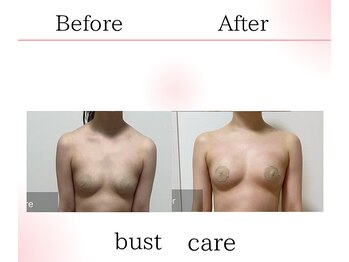 サロンツキ(salon tuki)/バストアップ