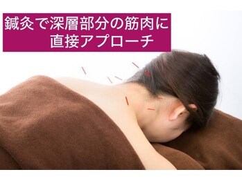 えとす整骨院の写真/【たるみ改善・くすみ改善に】肌の底からハリ革命！初回体験鍼灸(指圧マッサージ付き)¥5500