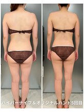 リッシュボーテ(RICHE BEAUTE)/【広尾/ハイパーナイフ/痩身】