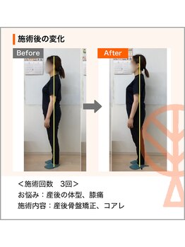 ただき接骨院 整体院 高関院/お悩み：産後の体型崩れ、膝痛
