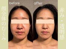 健志接骨院/πテラピー造顔メソッド