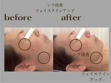 アイレ 桑名(aire)/フォトエステ