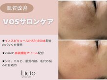 リエイト(Lieto)/VOSサロンケア