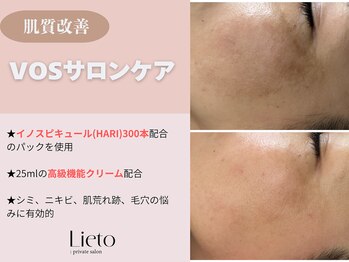 リエイト(Lieto)/VOSサロンケア