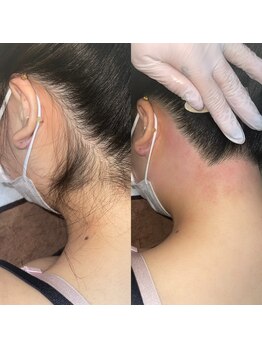 ヴィヴ 熊本(ViV)/うなじWAX