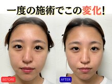 ナチュラルビューティーフェイス 横浜(NBF)