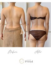 プラウド(Proud)/EMS引き締めボディ/上半身