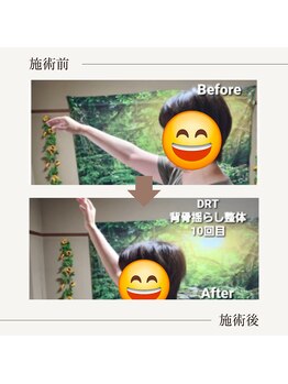 若石DRT整体サロン楽笑/肩もちゃんと上がるように！
