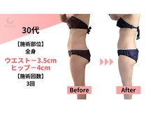 クレビア(Clevia)/Clevia-クレビア