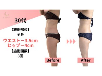 クレビア(Clevia)/Clevia-クレビア