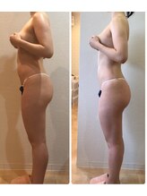 カロン(Kalon)/上半身集中痩せ