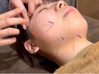 ザビー(THE B)の写真/一人一人のお肌のお悩みに徹底アプローチ！鍼灸のプロが豊富な知識で身体のお悩みを解消いたします！