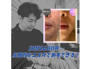 ビレンザ(vilenza)