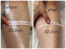 チル アンド リラックス(Chill and Relax)/むくみ解消