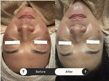 リマイン(Re mine)の雰囲気（大人のツヤを出すのが大得意！毛穴問題もツルっと解決させます）