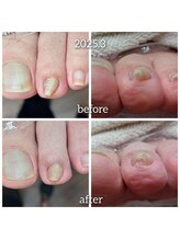 爪切り屋 足楽/