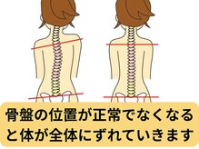 バランス鍼灸整骨院/骨盤の位置が不調の根源！