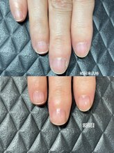 クーラ アンド ベリッシモ(Cura&Bellissimo)/自爪育成