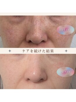 ミヤビ(miyabi)/ルネセル化粧品