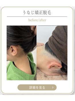 ミース 上野店/リピーター続出の施術