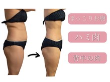 タノソイネ(tanosoine)の雰囲気（ハイパーナイフ痩身リンパ【リンパ/小顔/たるみ/痩身/むくみ】）