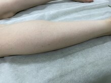 ナノハナ/鹿沼市全身脱毛美容室ナノハナ