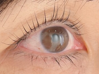 カラン 焼津店(CALIN)/ラスティングカール