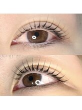 アオ(Ao)/【ラッシュリフト】