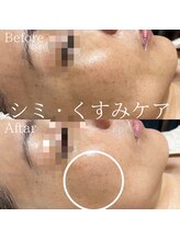 サロンディア(SALON Dea)/施術効果