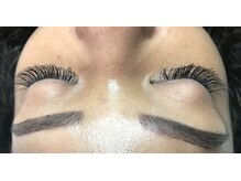 オランダエステティック(Holland Esthetics)/フラットラシユ 300本