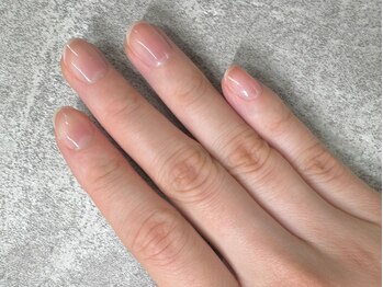 エイミー(Aimee)の写真/手元を綺麗に魅せたい方必見！保湿＆本格ケアで手荒れ/乾燥/薄爪などのお悩み解決◎