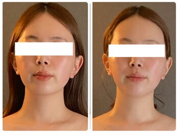 リジュ(Reju)/小顔・フェイシャル