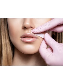 顔脱毛がしたい