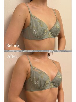 プリマベラ 大阪梅田(primabella)/デコルテにボリューム