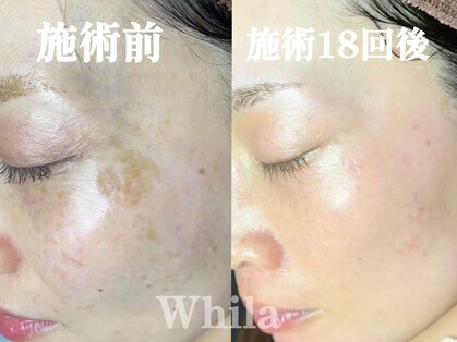 ホワラ 南青山店(Whila)の写真