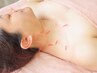 【平日16時まで限定★首肩こり/腰痛】部分鍼灸xhikari式間接灸 60分 ¥10000→