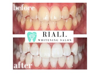 リアリ 宮崎(RIALI.)/学生さんにも大人気♪