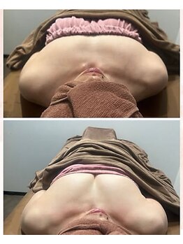 ロココ 横浜店(Rococo)/産後授乳後にバストを取り戻す