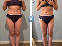 コスメ デ グレース(cosme de greace)/マイナス５キロウルトラナイフ