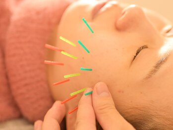 アロエベル(aloe Belle)/美容鍼