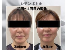 フルーア(FULUA)/レモンボトル