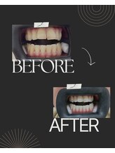 セルフダック 栃木小山店(SELFDUCK)/40代　男性