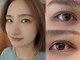ネストアイ(NEST eye)の写真