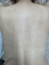 ナノハナ/鹿沼市の全身脱毛のナノハナ