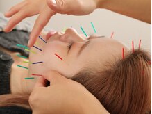 リム(Rim.)の雰囲気（オーダーメイドの美容鍼や頭皮鍼で小顔に！眼精疲労や頭痛にも☆）