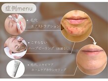 アメリオレ 三鷹店(AMELIORER)/肌育、美肌改善ケアで大人気♪