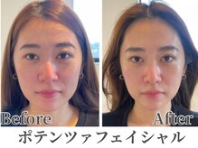 フェミナ(femna)の雰囲気（毛穴の開き/たるみ/むくみ/老け顔にお悩みの方におすすめ★）
