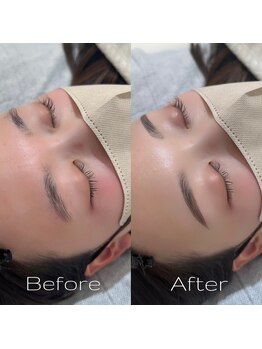 ビビ(BIBI)/ハリウッドブロウリフト