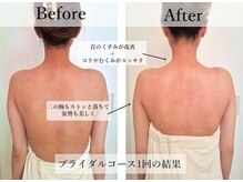 アモントベールの雰囲気（パワーレメディーは老廃物を流し、くすみや浮腫みもとれます★）